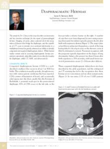 Diaphragmatic Hernias LEIGH S. SHUMAN, M.D. Staff Radiologist, Lancaster General Hospital Lancaster Radiology Associates, Ltd.  The article by Dr. Chory in this issue describes an innovative