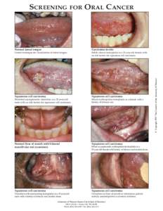 Screening For Oral Cancer.qxd