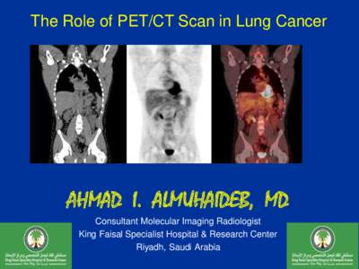 The Role of PET/CT Scan in Lung Cancer  AHMAD I. ALMUHAIDEB, MD Consultant Molecular Imaging Radiologist King Faisal Specialist Hospital & Research Center Riyadh, Saudi Arabia