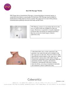 How VNS Therapy® Works VNS (Vagus Nerve Stimulation) Therapy, a neurostimulation treatment option, is sometimes described as a pacemaker for the brain. VNS Therapy may be added to medications to help improve seizure con