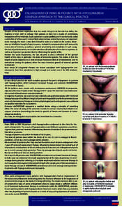 Anatomy / Micropenis / Human penis size / Hypogonadism / Penis enlargement / Kallmann syndrome / Testosterone / Erection / Puberty / Medicine / Penis / Health