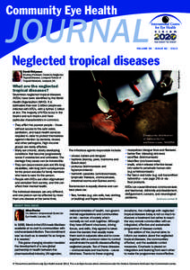 Community Eye Health  Journal VOLUME 26 | ISSUE 82 | 2013
