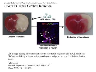 from the Laboratory of Regenerative medicine and Stem Cell Biology,  Good EPC repair Cerebral Infarction GFP labeled EPC