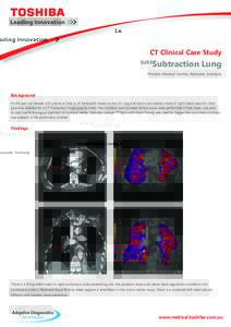 CT Clinical Case Study SURE Subtraction Lung  Flinders Medical Centre, Adelaide, Australia