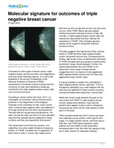 Molecular signature for outcomes of triple negative breast cancer