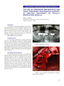Journal of IMAB - Annual Proceeding (Scientific Papers) 2009, book 2  THE USE OF TEMPORARY MINI-IMPLANTS FOR FIXED TEMPORARY RESTORATION SUPPORT AT IMPLANT TREATMENT OF TOTALLY EDENTULOUS MAXILLA