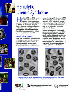 Hemolytic Uremic Syndrome H  inated. Some people have contracted HUS