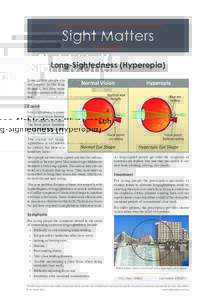 Long-Sightedness (Hyperopia) Long-sighted people can see clearer in the long distance, but they have blur or eyestrain with close tasks.
