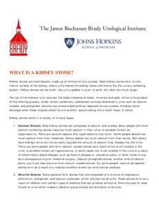 The James Buchanan Brady Urological Institute  WHAT IS A KIDNEY STONE? Kidney stones are hard objects, made up of millions of tiny crystals. Most kidney stones form on the interior surface of the kidney, where urine leav