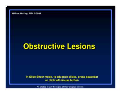 LearningRadiology-Obstuctive Cardiac Lesions, CHF, Infancy