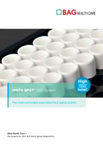 High resolution available HISTO SPOT ® SSO System The most convenient automated HLA typing system