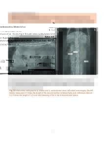 Supplementary Material zu R. Heilmann et al.: Beidseitiger Einsatz eines subkutanen Ureter‐Bypass bei einer Katze mit bilateraler Harnleiterobstruktion. Tierärztl Prax; doi: TPK‐,1 cm 5,0 cm