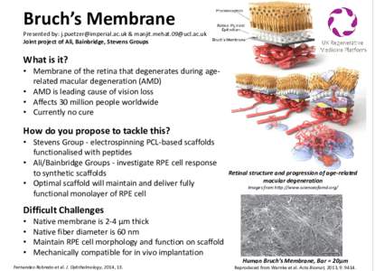 Bruch’s Membrane  Presented by:  &  Joint project of Ali, Bainbridge, Stevens Groups  What is it?