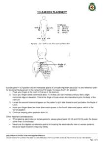 12 LEAD ECG PLACEMENT  Locating the V1/C1 position (fourth intercostal space) is critically important because it is the reference point for locating the placement of the remaining V/C leads. To locate the V1/C1 position:
