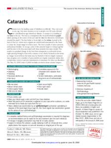 The Journal of the American Medical Association  Cataracts Cross section of normal eye