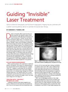 RETINA surgery FEATURE STORY  Guiding “Invisible” Laser Treatment Optical coherence tomography and fluorescein angiography imaging may be combined with a pattern scanning delivery device to optimize micropulse laser 