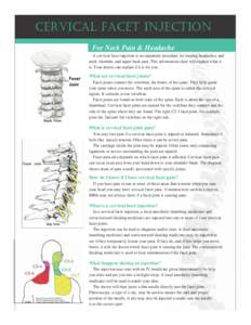 CerviCal FaCet injeCtion For Neck Pain & Headache A cervical facet injection is an outpatient procedure for treating headaches, and neck, shoulder, and upper back pain. This information sheet will explain what it is. You