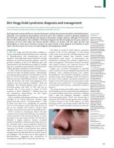 Birt-Hogg-Dubé syndrome: diagnosis and management