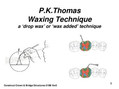 P.K.Thomas Waxing Technique a ‘drop wax’ or ‘wax added’ technique Construct Crown & Bridge Structures 510B Ver2