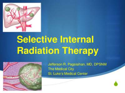 Selective Internal Radiation Therapy Jefferson R. Pagsisihan, MD, DPSNM The Medical City St. Luke’s Medical Center