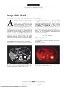 SPECIAL FEATURE SECTION EDITOR: CARL E. BREDENBERG, MD Image of the Month The´ odoros Thomopoulos, MD; Gilles Mentha, MD; Christian Toso, MD, PhD