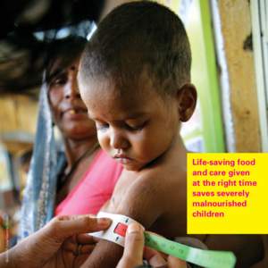 ©UNICEF India/Giacomo Pirozzi  Life-saving food and care given at the right time saves severely
