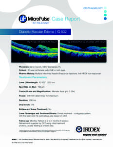 ™  Case Report Diabetic Macular Edema | IQ 532 OD Pre-Op. VA: 20/60, CRT: 403 µm