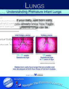 Lungs Understanding Premature Infant Lungs If your baby was born early, you already know how fragile preemie lungs can be. PRETERM LUNGS