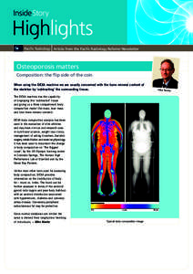 InsideStory  Highlights Article from the Pacific Radiology Referrer Newsletter  Osteoporosis matters