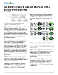 Wii Balance Board induces changes in the brains of MS patients
