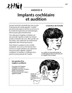 227  ANNEXE B Implants cochléaire et audition