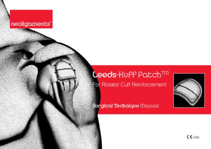 Leeds-Kuff PatchTM For Rotator Cuff Reinforcement Surgical Technique Manual  0086