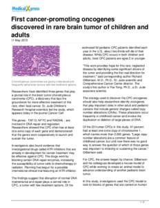 First cancer-promoting oncogenes discovered in rare brain tumor of children and adults
