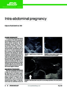 Medical emergencies / Pregnancy / Fertility / Obstetrics / Developmental biology / Ectopic pregnancy / Abdominal pregnancy / Placenta accreta / Polyhydramnios / Medicine / Reproduction / Biology