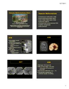 Microsoft PowerPoint - vascular malf lect Smith RSNA 2011.ppt [Compatibility Mode]
