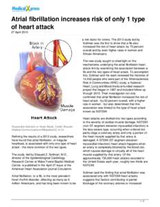 Atrial fibrillation increases risk of only 1 type of heart attack