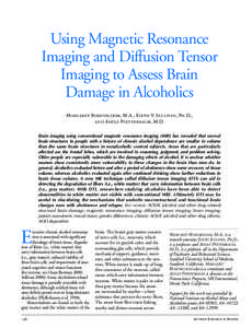 Using Magnetic Resonance Imaging and Diffusion Tensor Imaging to Assess Brain Damage in Alcoholics