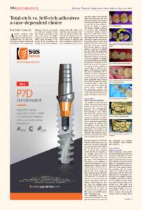 10 rEStorativE  Dental tribune Middle East & Africa Edition | May-June 2015 Total-etch vs. Self-etch adhesives a case-dependent choice