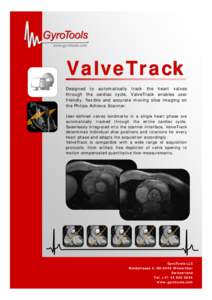 www.gyrotools.com  ValveTrack Designed to automatically track the heart valves through the cardiac cycle, ValveTrack enables user friendly, flexible and accurate moving slice imaging on