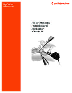 Hip Series Technique Guide Hip Arthroscopy Principles and Application