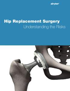 Hip Replacement Surgery 	 Understanding the Risks Understanding the Risks of Your Hip Replacement Surgery