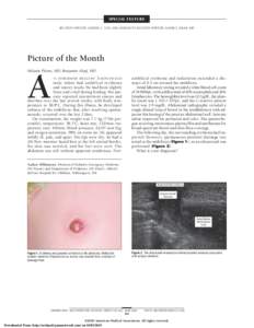 SPECIAL FEATURE SECTION EDITOR: ALBERT C. YAN, MD; ASSISTANT SECTION EDITOR: SAMIR S. SHAH, MD Picture of the Month Melanie Pitone, MD; Benjamin Alouf, MD