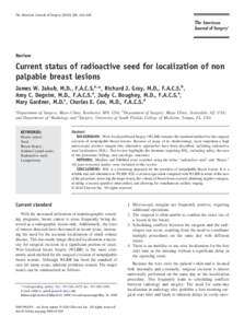 Current status of radioactive seed for localization of non palpable breast lesions