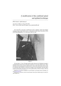 A modification of the combined spinal and epidural technique RWD Nickalls 1 and B Dennison 2 Anaesthesia (1984); vol. 39, pp. 935–936 http://www.nickalls.org/dick/papers/anes/spinalclip1984.pdf