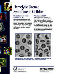 Hemolytic Uremic Syndrome in Children