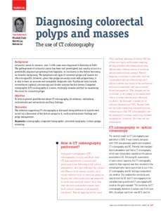 Diagnosing colorectal polyps and masses – the use of CT colonography