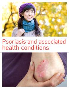 Psoriasis and associated  health conditions People with psoriasis may develop other health conditions.