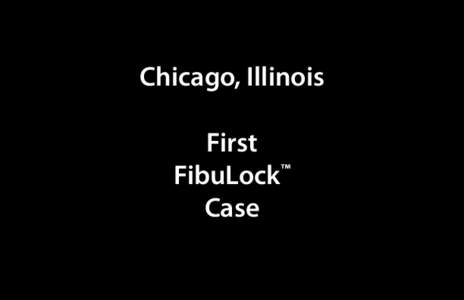 Chicago, Illinois First FibuLock™ Case  Entry point with K-wire