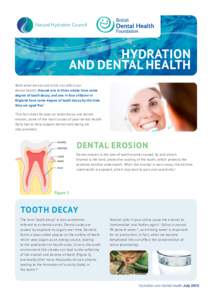 Oral hygiene / Acute pain / Dental caries / RTT / Tooth enamel / Human tooth / Water fluoridation / Acid erosion / Dental public health / Dentistry / Toothpaste / Saliva