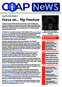 April 2015 ISSUE 4  Focus on... Hip Fracture Provision of care for patients with fractures of the hip involves multidisciplinary teams from ambulance and emergency care through surgery, post-operative care, rehabilitatio
